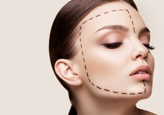 face-lift