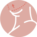 face-lift