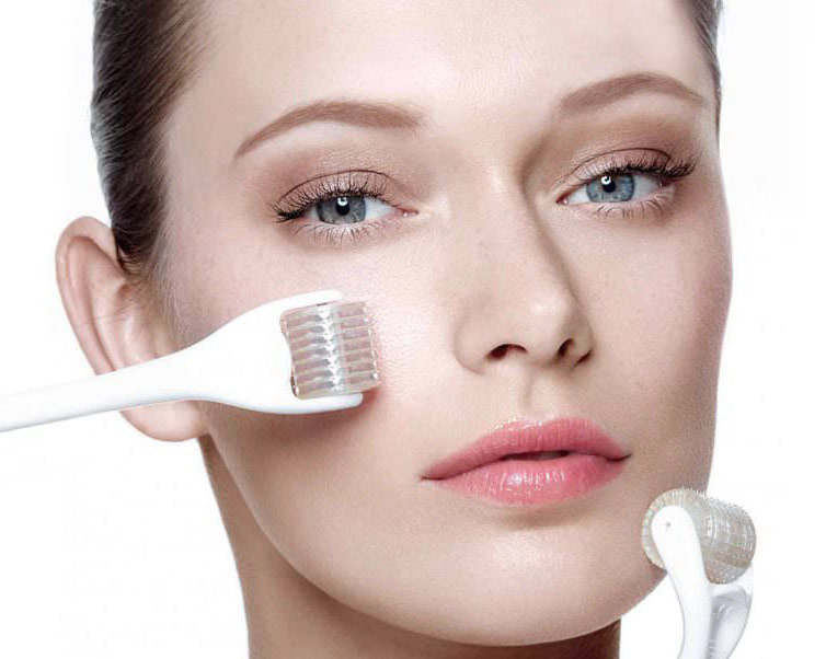 mesotherapeia-microneedling Microneedling