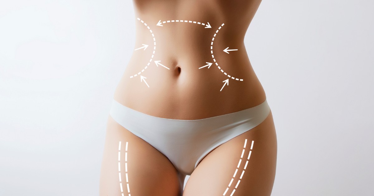 belly fat treatments