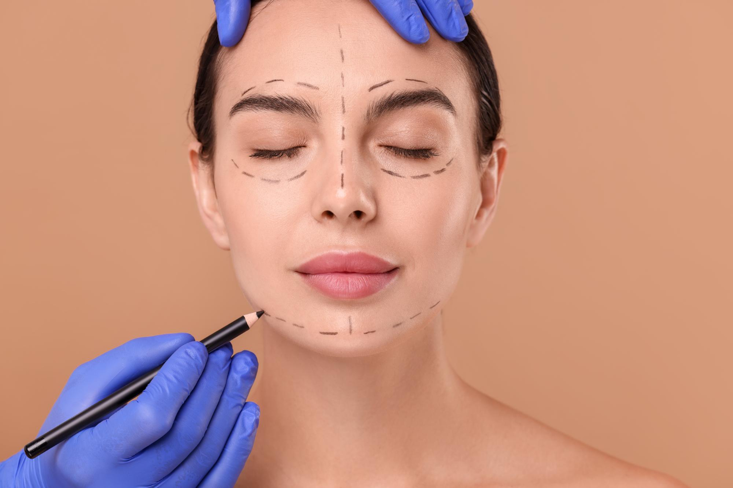 face contouring με υαλουρονικό