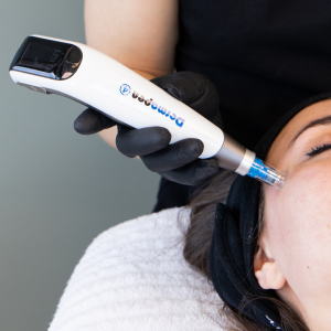 Dermapen πόσο συχνά